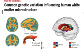 40+文章：全基因组关联研究（GWAS）脑白质微结构与脑疾病及认知功能的遗传相关性