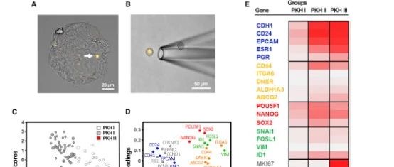 单细胞测序研究乳腺癌分析套路介绍