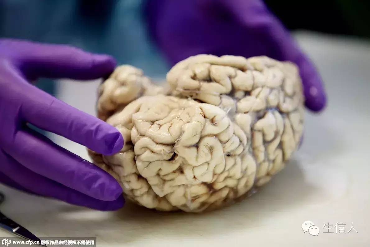 让大脑存活就能实现永生？